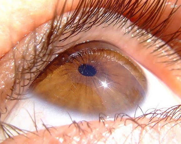 Photo dans le blanc des yeux ! Photo dans le blanc des yeux !